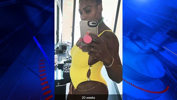 Serena Williams annonce qu'elle est enceinte (c) Instagram, Liberation